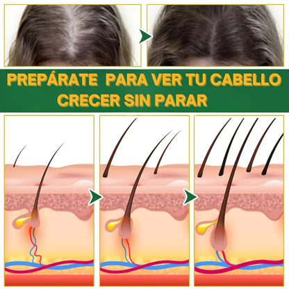 Ouhoe™ Elixir Capilar: Recupera tu Cabello y detiene la caída, fórmula herbal con ginseng + jengibre